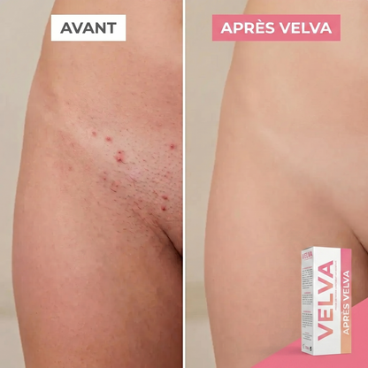 Rasoir 2 en 1 | Anti Irritations Et Poils Incarnés