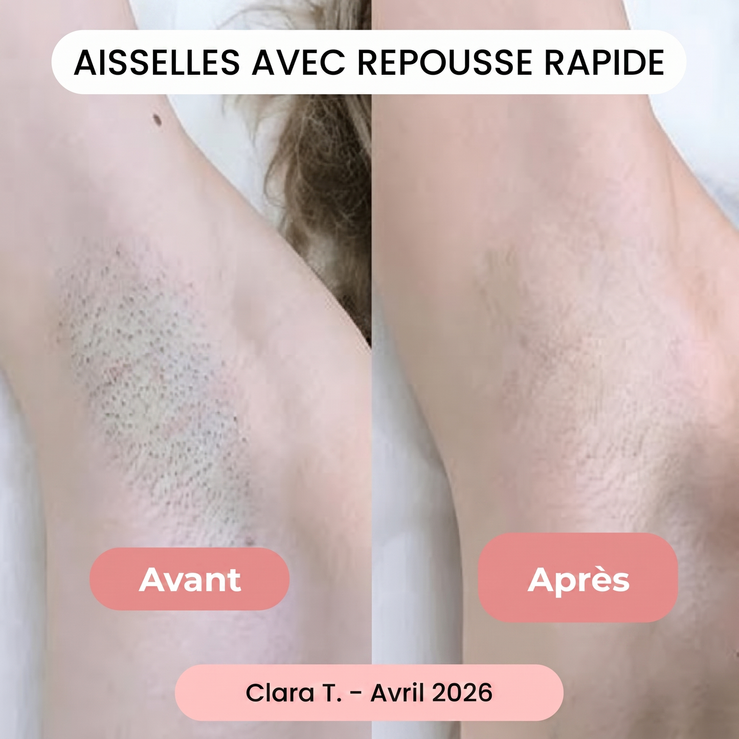 Huile Anti Poils Résultats Dès le Premier Mois
